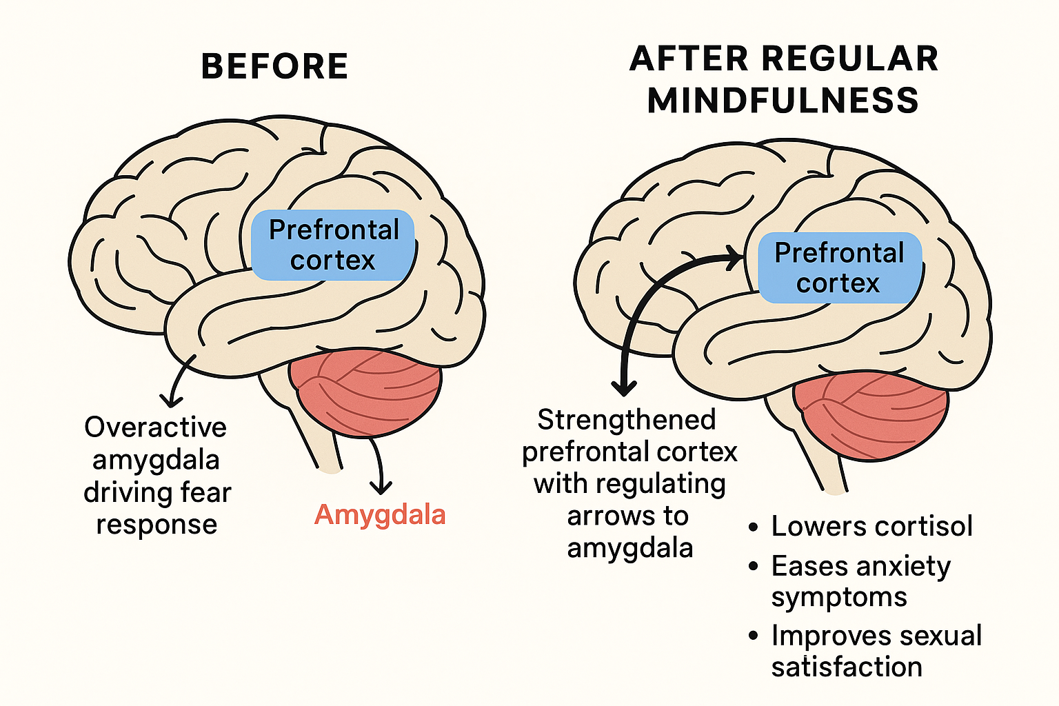 Brain diagram showing mindfulness regulation of anxiety responses